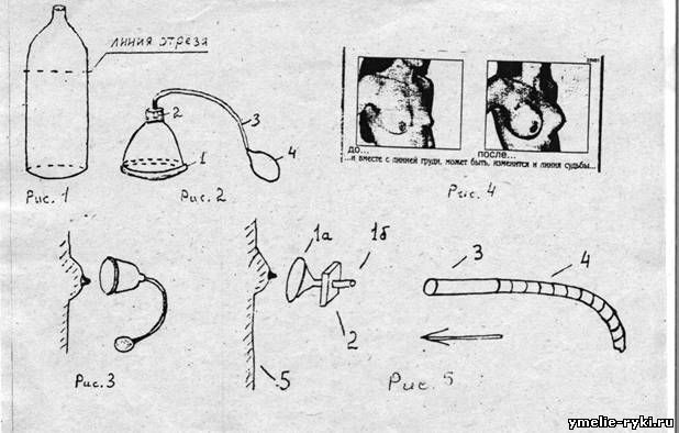 самодельный корректор груди